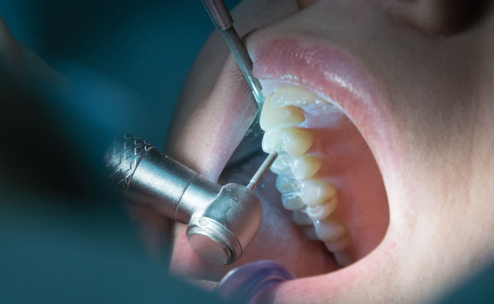 Imagen de Endodoncia