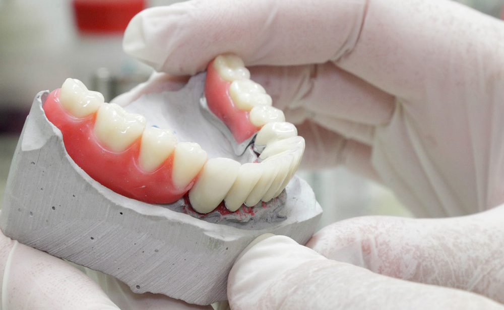 Rehabilitación Protésica