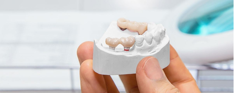 Rehabilitación Protésica