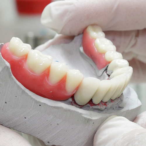 Rehabilitación Protésica