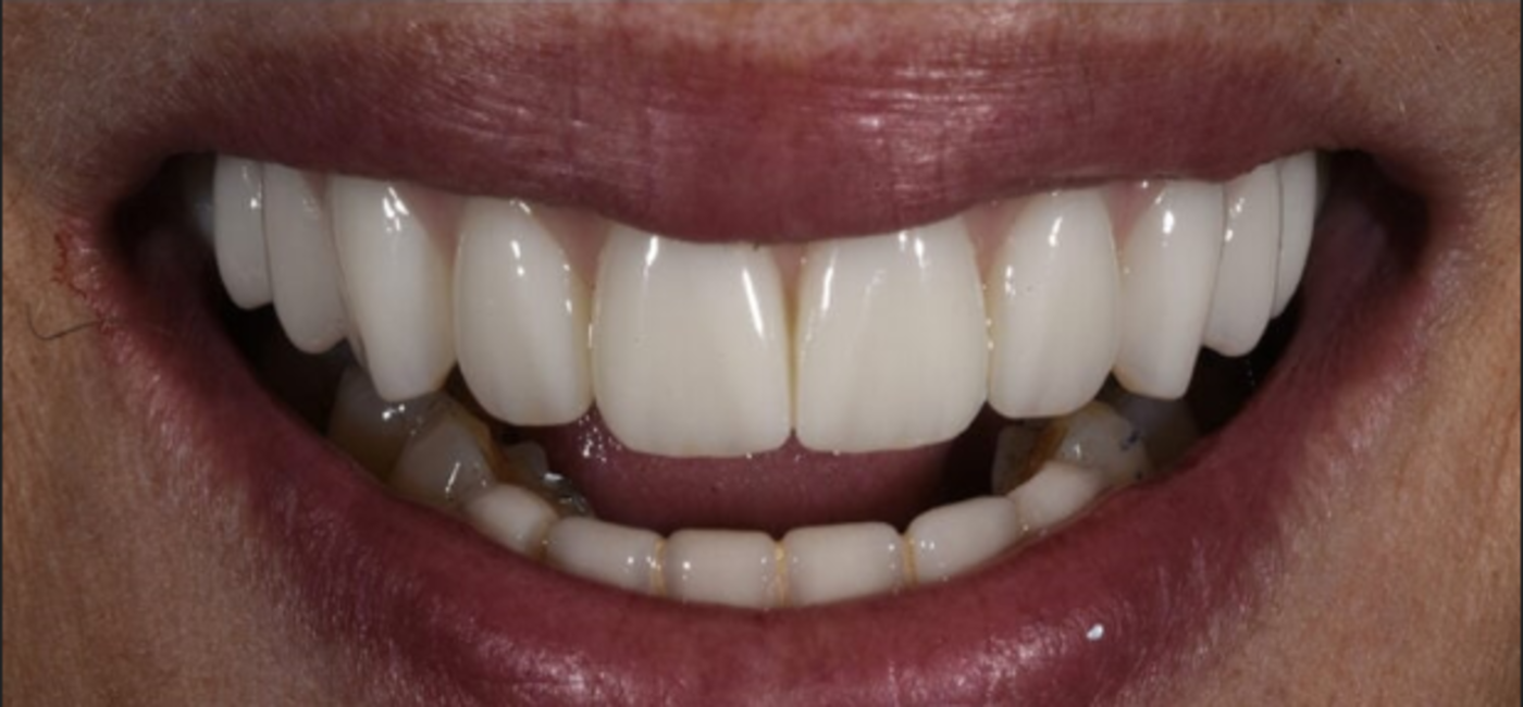 After Image