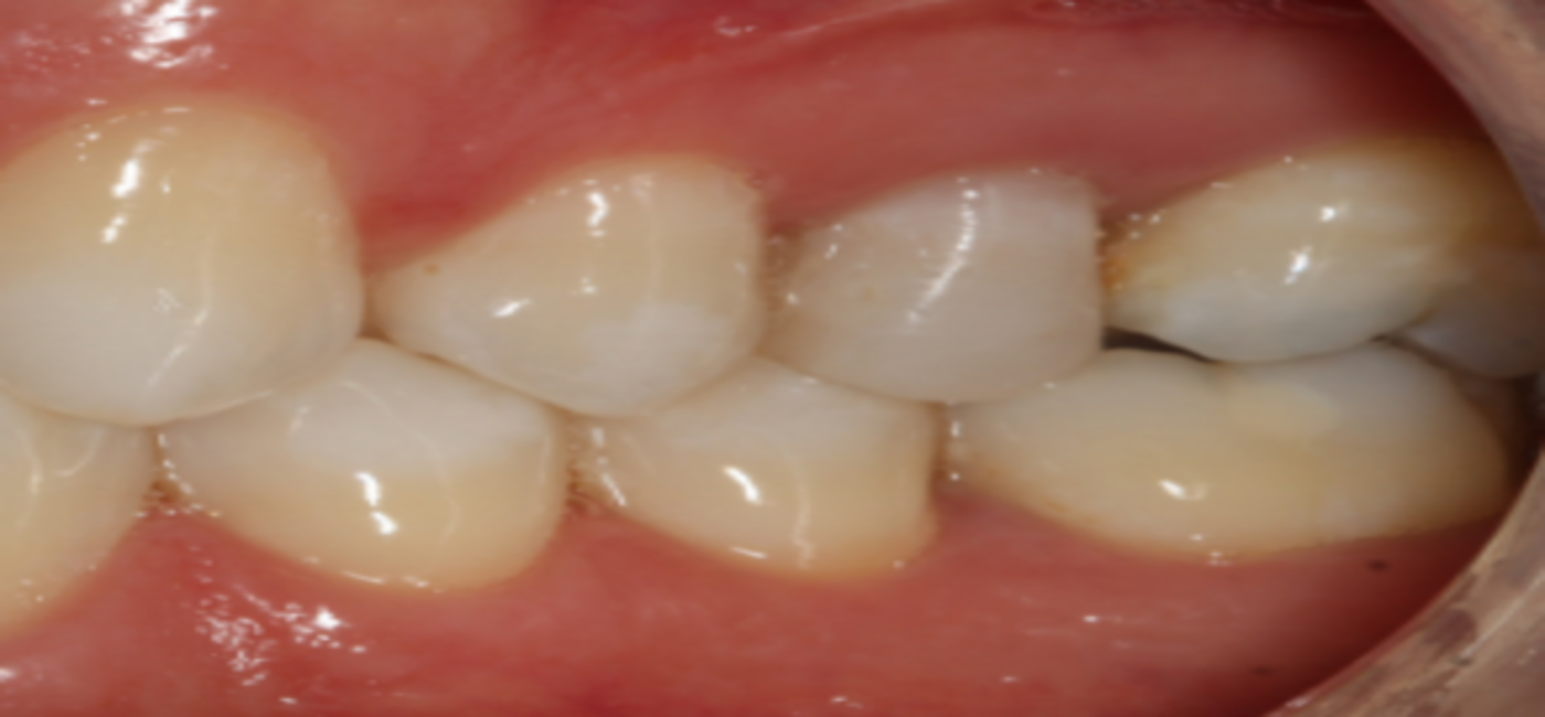 After Image