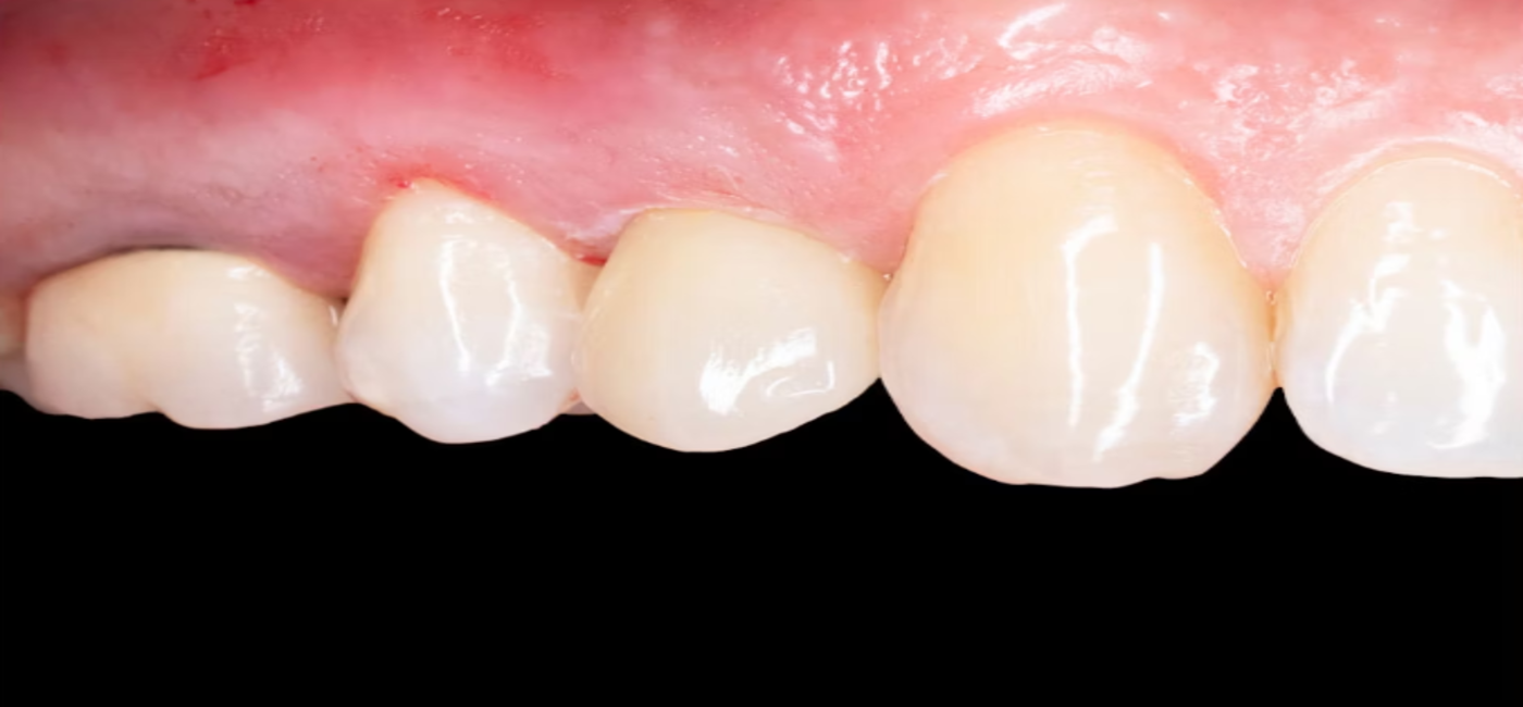 After Image