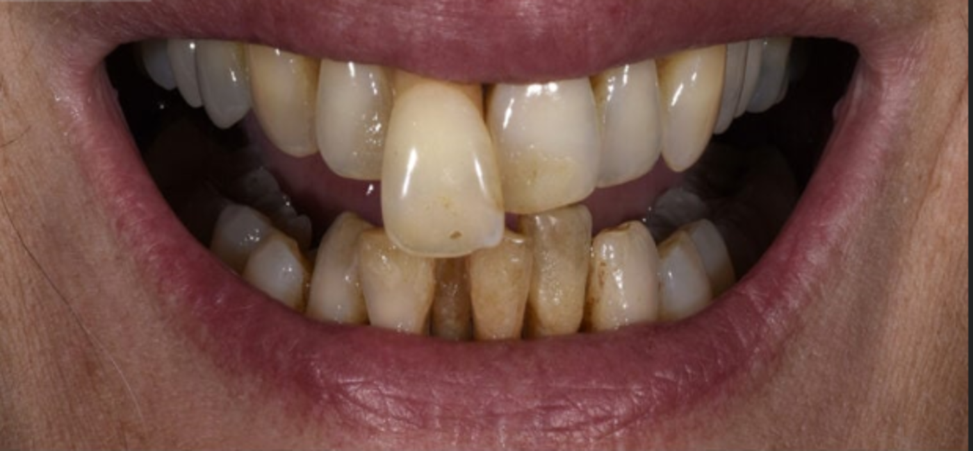 Before Image