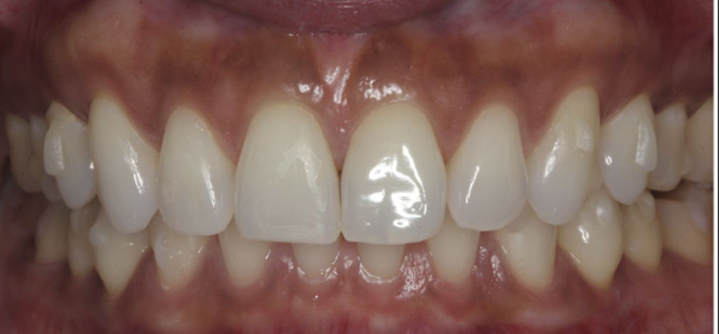 Before Image
